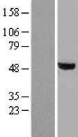SMAD2 Human Over-expression Lysates NM_001003652