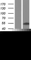 SMAD3 Human Over-expression Lysates NM_001145103