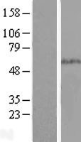 SMAD5 Human Over-expression Lysates NM_001001419