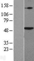 SMAD5 Human Over-expression Lysates NM_005903
