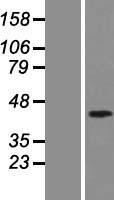 MADH7 (SMAD7) Human Over-expression Lysates NM_005904
