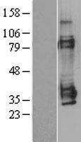 MAGE 1 (MAGEA1) Human Over-expression Lysates NM_004988