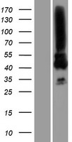 MAGEA3 Human Over-expression Lysates NM_005362