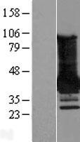 MAGEA4 Human Over-expression Lysates NM_001011549
