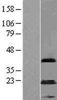 MAGEA5 Human Over-expression Lysates NM_021049