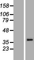 MAGEA6 Human Over-expression Lysates NM_175868