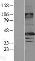 ls004107 magea8 human over expression lysates nm 005364 wb testing 2