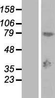 MAGEA9 Human Over-expression Lysates NM_005365