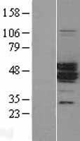 MAGEA11 Human Over-expression Lysates NM_005366