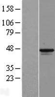 MAGEB1 Human Over-expression Lysates NM_002363