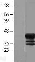 MAGEB4 Human Over-expression Lysates NM_002367