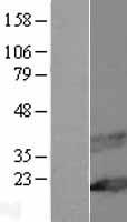 MAL Human Over-expression Lysates NM_022440