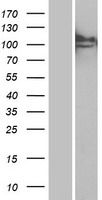 ls004125 man2b1 human over expression lysates nm 000528 wb testing 1