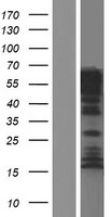 ls004135 map6 human over expression lysates nm 207577 wb testing 2