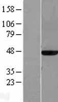 MAT2A Human Over-expression Lysates NM_005911