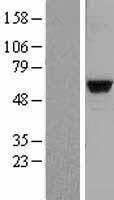 MATK Human Over-expression Lysates NM_139355