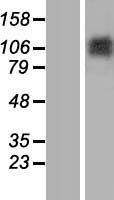 Matrilin 2 (MATN2) Human Over-expression Lysates NM_002380