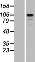 Matrilin 2 (MATN2) Human Over-expression Lysates NM_030583