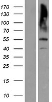 Matrilin 3 (MATN3) Human Over-expression Lysates NM_002381
