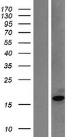 Myoglobin (MB) Human Over-expression Lysates NM_203377