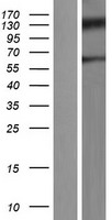 MBD1 Human Over-expression Lysates NM_015844