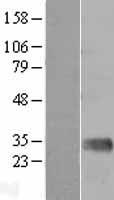 ls004153 mannan binding lectin mbl2 human over expression lysates nm 000242 wb testing 1