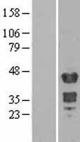 MBNL1 Human Over-expression Lysates NM_021038