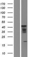 MBNL1 Human Over-expression Lysates NM_207293