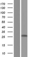 Myelin Basic Protein (MBP) Human Over-expression Lysates NM_001025081