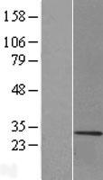 ls004155 myelin basic protein mbp human over expression lysates nm 001025100 wb testing 6