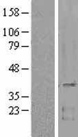 MC1 Receptor (MC1R) Human Over-expression Lysates NM_002386