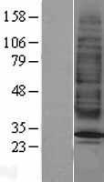 MC2 receptor (MC2R) Human Over-expression Lysates NM_000529