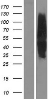 MC4 Receptor (MC4R) Human Over-expression Lysates NM_005912