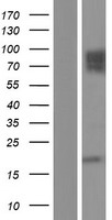 CD146 (MCAM) Human Over-expression Lysates NM_006500