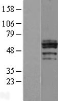 CHST6 Human Over-expression Lysates NM_021615