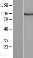 MCM3 Human Over-expression Lysates NM_002388
