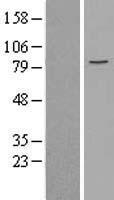 MCM5 Human Over-expression Lysates NM_006739