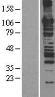 MCM6 Human Over-expression Lysates NM_005915