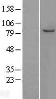 MCM7 Human Over-expression Lysates NM_005916
