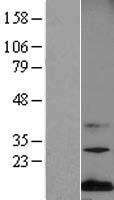 Midkine (MDK) Human Over-expression Lysates NM_001012334