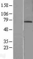 MDM2 Human Over-expression Lysates NM_002392