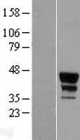 MEIS2 Human Over-expression Lysates NM_002399