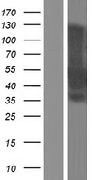 MEIS2 Human Over-expression Lysates NM_170674