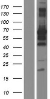 MEIS2 Human Over-expression Lysates NM_170675
