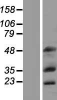 MOX1 (MEOX1) Human Over-expression Lysates NM_001040002