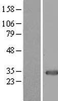 MOX1 (MEOX1) Human Over-expression Lysates NM_004527