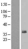 MEST Human Over-expression Lysates NM_177525