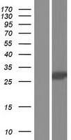 MAGP1 (MFAP2) Human Over-expression Lysates NM_001135247
