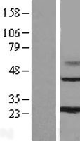 MAGP1 (MFAP2) Human Over-expression Lysates NM_017459
