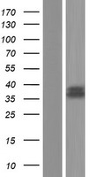 Manic Fringe (MFNG) Human Over-expression Lysates NM_001166343